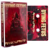 Dying Fetus - Reign Supreme Cassette