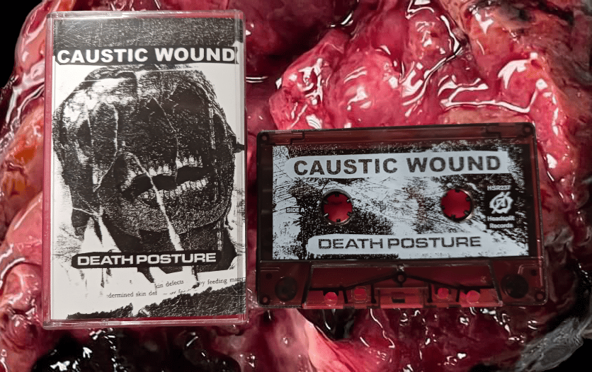 Image of Caustic Wound - Death Posture 