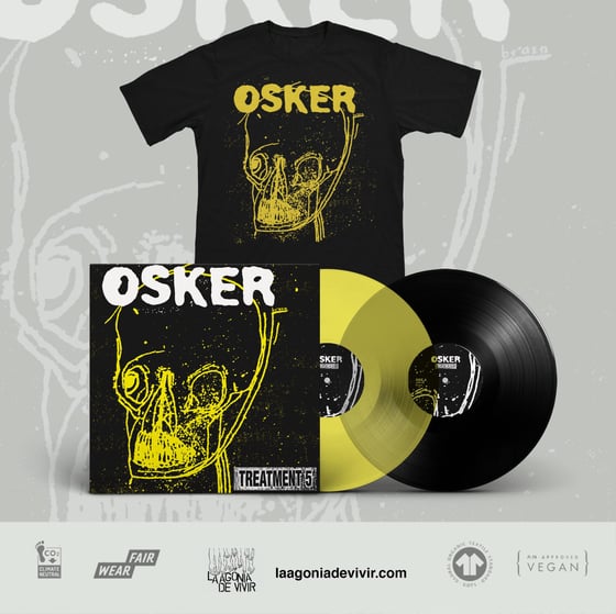 Image of OSKER "treatment 5" BUNDLE (LP reissue + Tshirt)