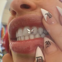 Butterfly Tooth Gem Kit 