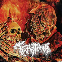 Teratoma – Purulent Manifestations