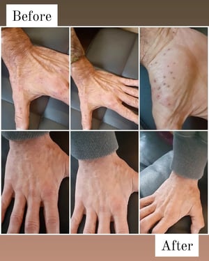 Image of 🌿Herbal Medicated Skin Cream - formulated for eczema