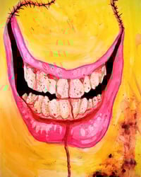 Tooth Pain