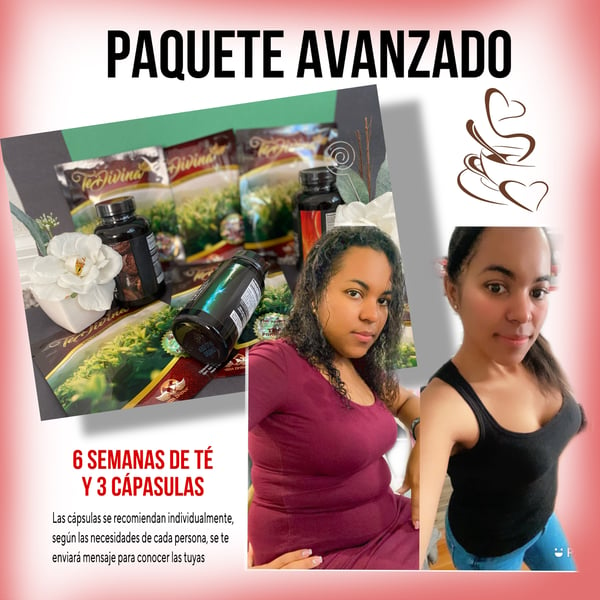 Image of Paquete Avanzado