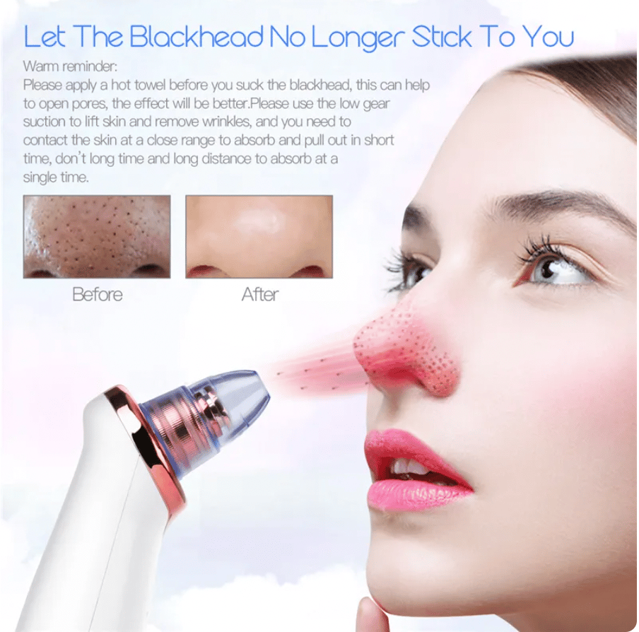 Image of PRE ORDER - Electric Blackhead Remover for Pore Cleansing and Acne Treatment