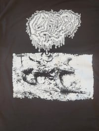 Image 2 of Fetal Deformity - Rotting Corpse shirt
