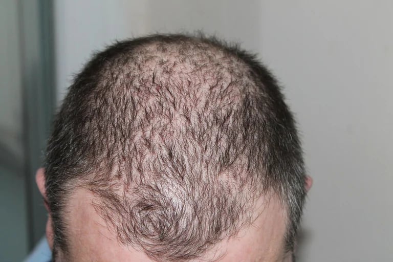 PROS-TATE! Prostate-Blood Pressure-Blood Sugar-Detoxer-Hair Loss-Eczema-Osteoarthrits