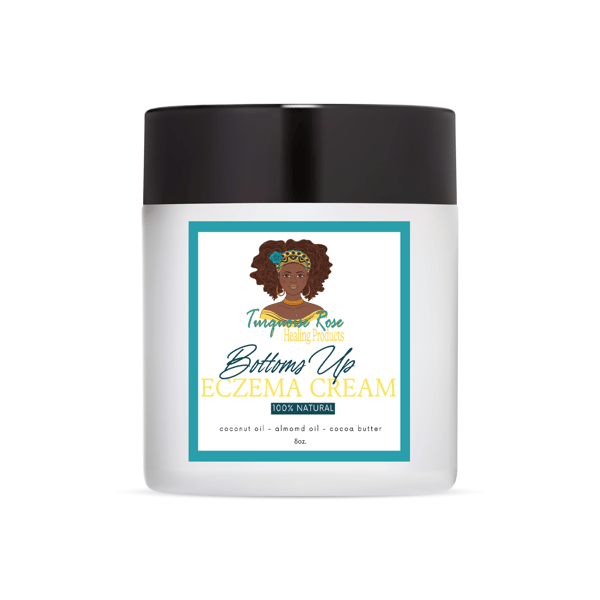 Image of Bottoms Up Eczema Cream 