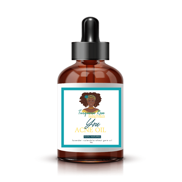Image of You Acne Oil
