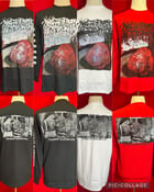 Image of Officially Licensed Malignant Hyperthermia "Cutaneous Blastomycosis" Cover Art Shirt!!