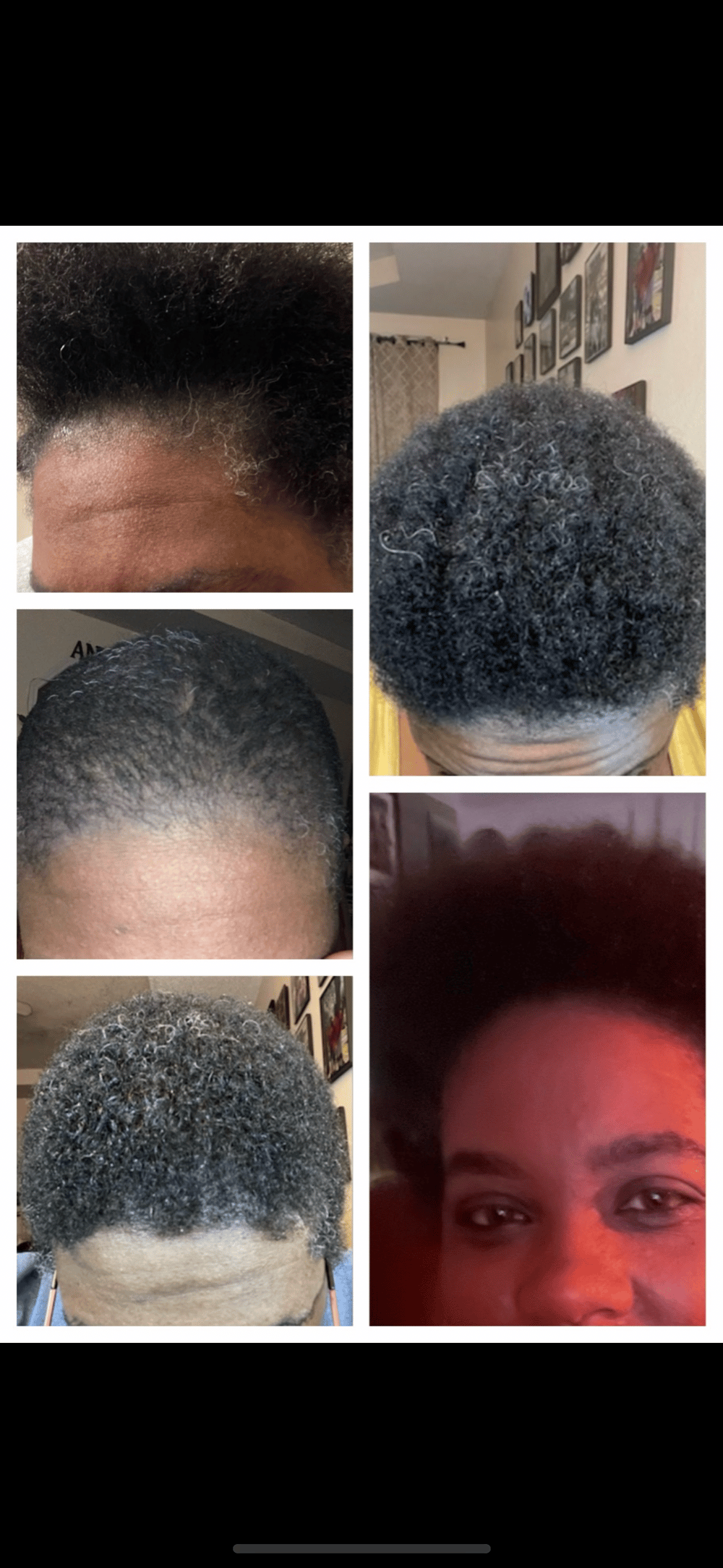 Image of Hair Bomb 💣 Growth Oil