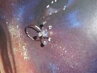 Image 5 of Aquarius Paludum Ring