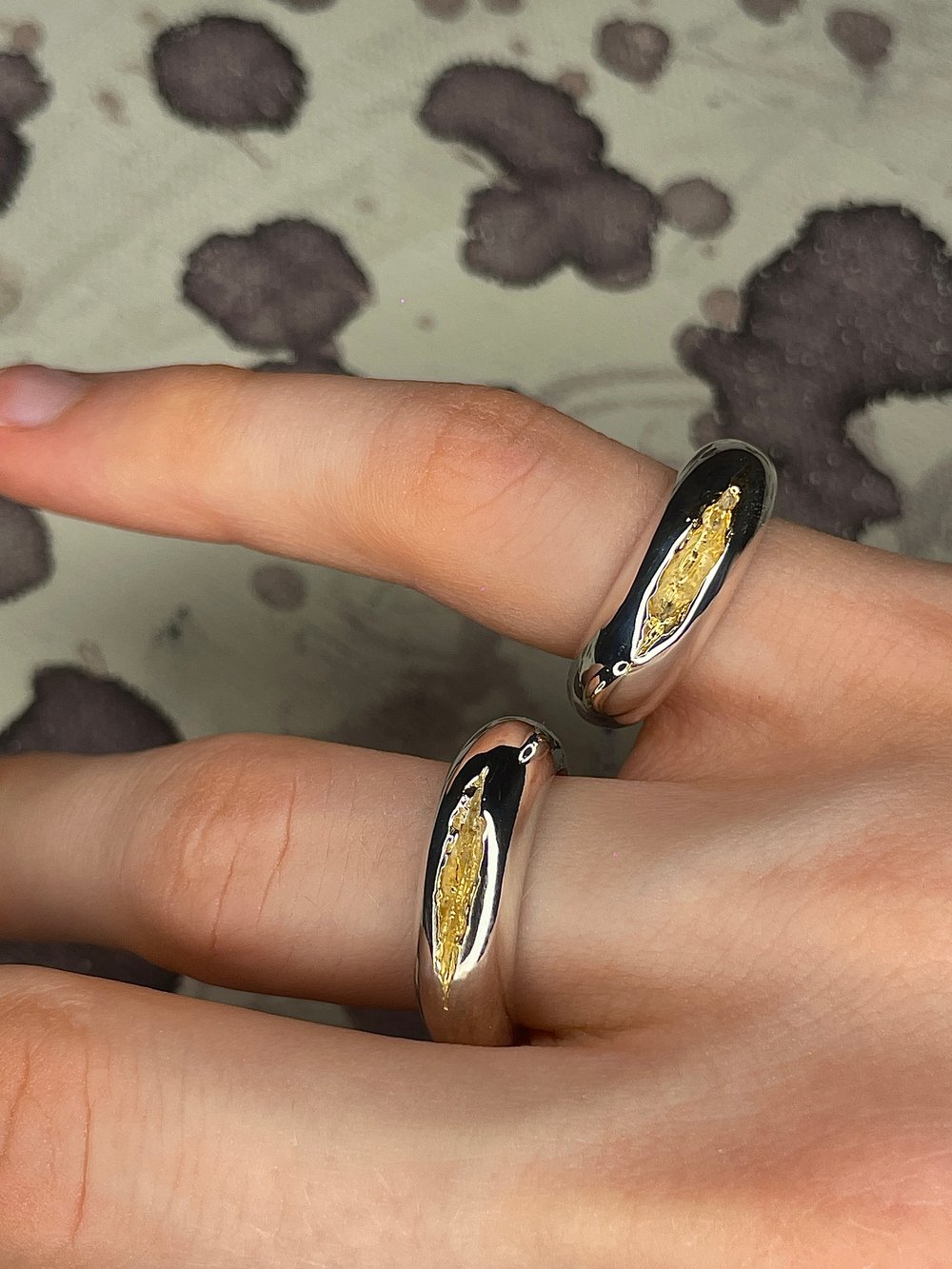 scar ring
