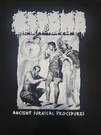 Image 2 of Lipoma - Ancient Surgical Procedures shirt