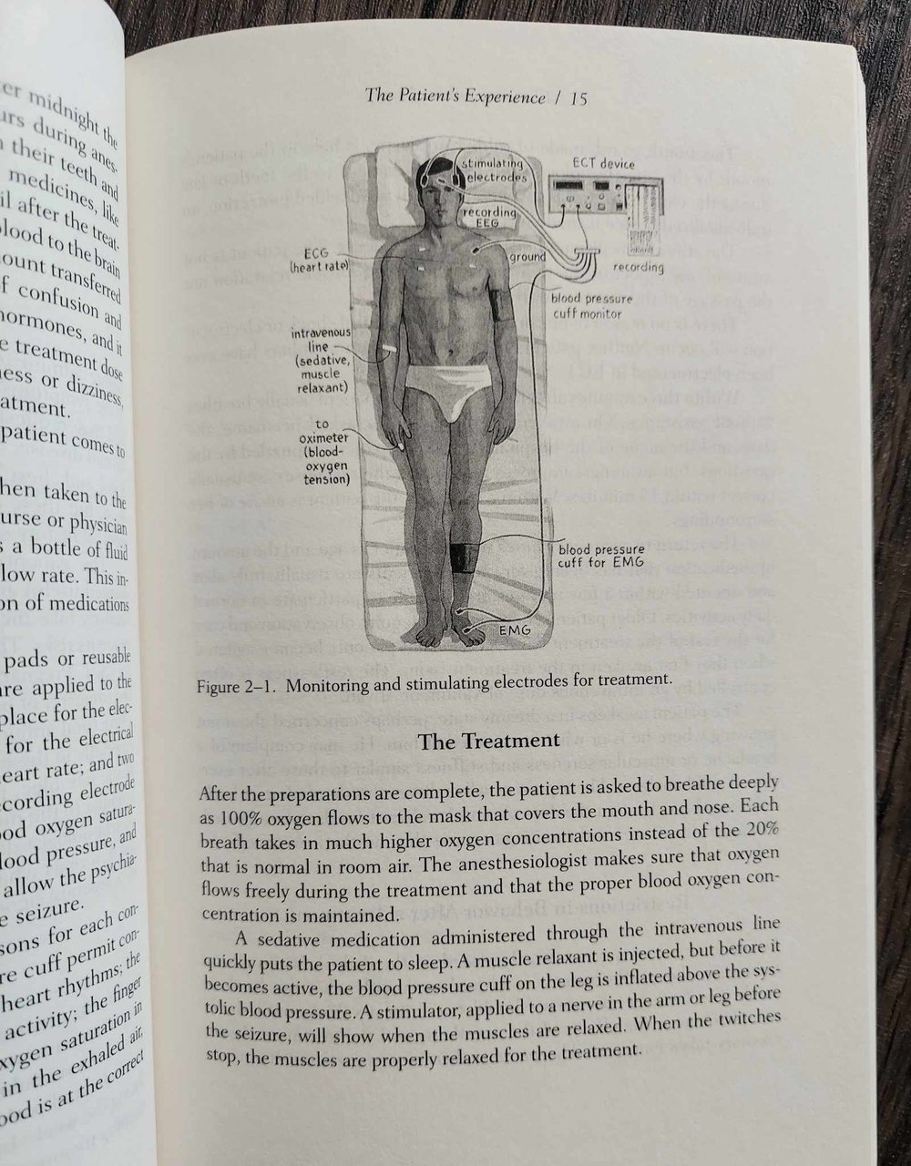 Electroconvulsive Therapy: A Guide for Professionals and Their Patients, by Max Fink