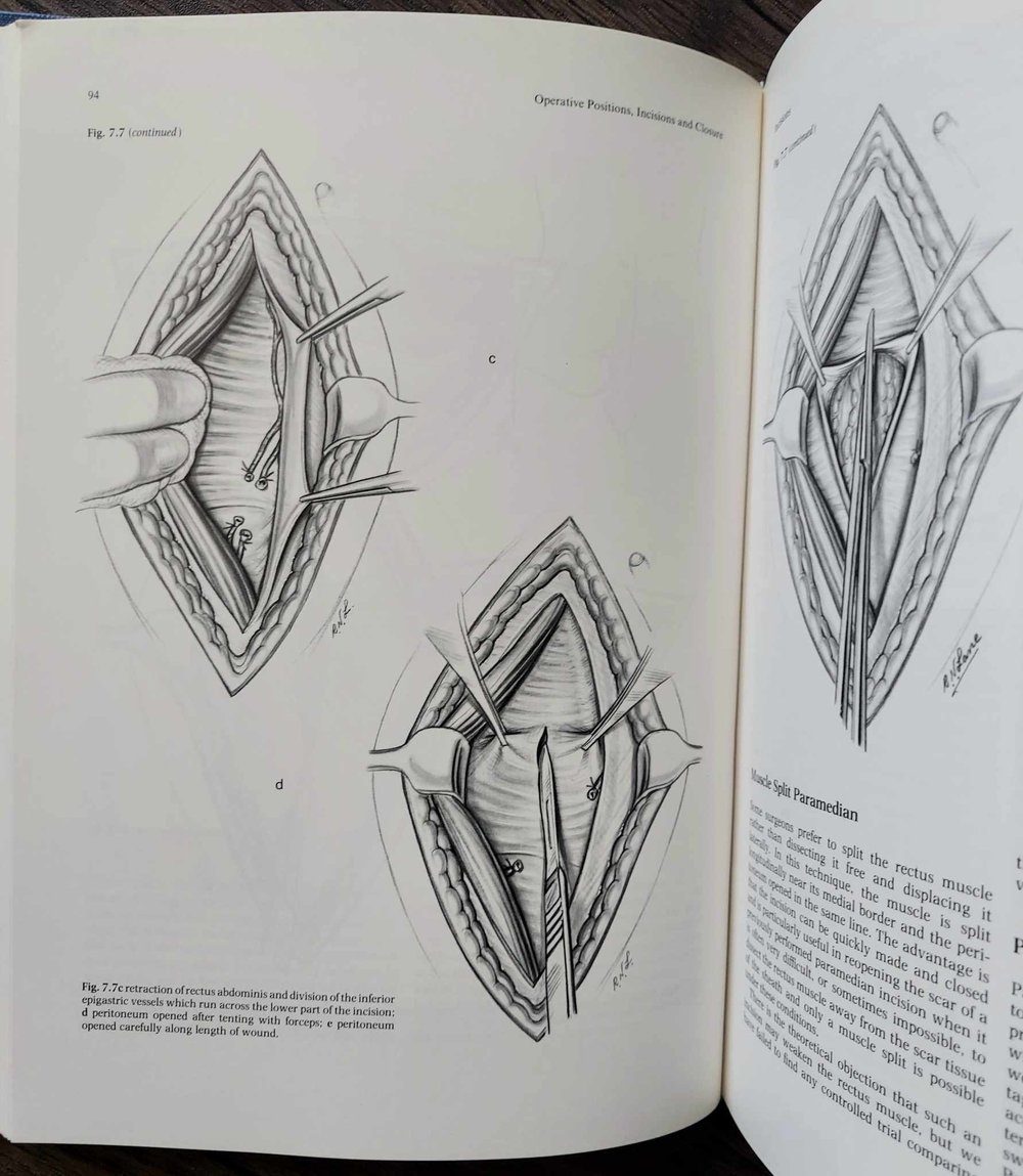 Principles of Gynaecological Surgery, by Stuart L. Stanton