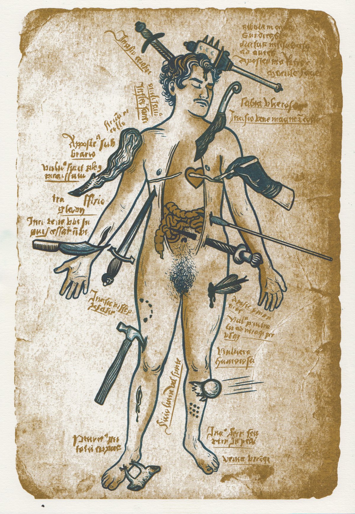 Image of Trans Wound Man Riso Print