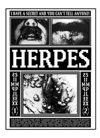 Image 1 of "HERPES" INFORMATION POSTER