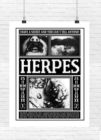 Image 2 of "HERPES" INFORMATION POSTER