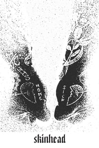 Image of Skinhead “Home Sick” CASS PRE-ORDER