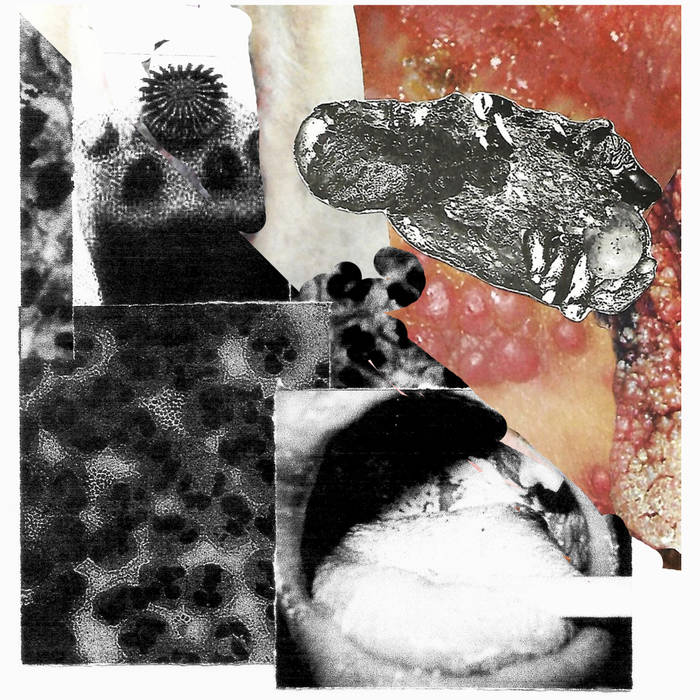 Image of  Hemorrhagic Pyrexia Virus / Gonococcus split 7"
