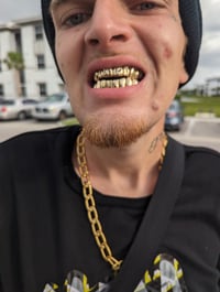 Image of GOLDYLOXGRILLZ 14k yellow and white gold 