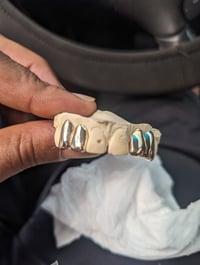 Image of GOLDYLOXGRILLZ 14k yellow and white gold 
