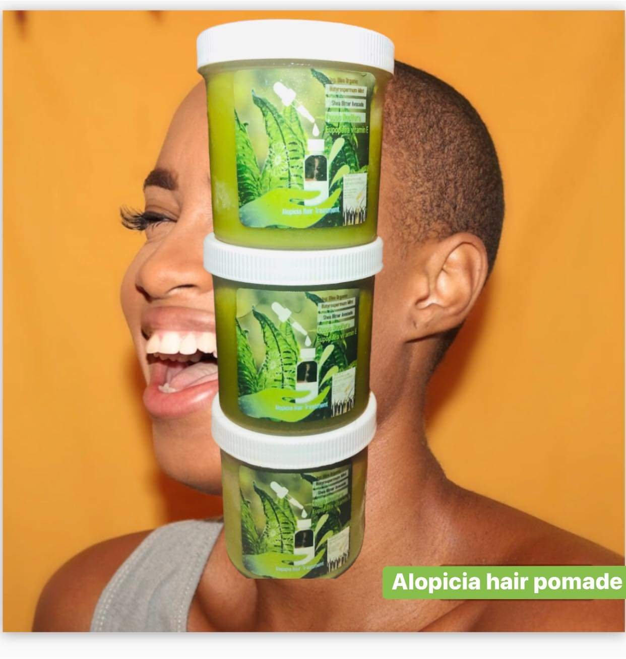Image of Alopicia Hair Loss Sets 5PCS