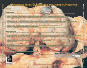 Biocyst - A Monotonous Plethora of Profusely Compiled Sanguineous Putrefactions CD 