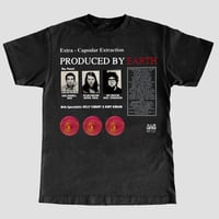 Image 2 of EXTRA - CAPSULAR EXTRACTION