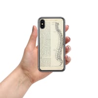 Image 3 of Vintage Book Page Anatomical Illustration Human Spine Clear Case for iPhone®