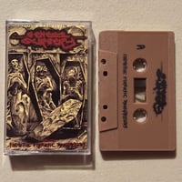 Image 2 of GENERAL SURGERY - “Formitive Forensic Transgressions” cassette