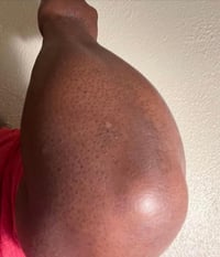 Image 8 of “BRIGHTER SKIN” PEELING OIL 