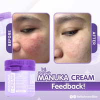 Image 3 of Manuka Cream 