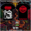 CREPITATION - MONSTROUS ERUPTION OF IMPETUOUS PREPOSTEROSITY T-SHIRT PACKAGE