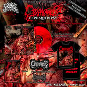 Image of CEPHALOTRIPSY	Uterovaginal Insertion Of Extirpated Anomalies PACKAGE  LP - PRE-ORDER 
