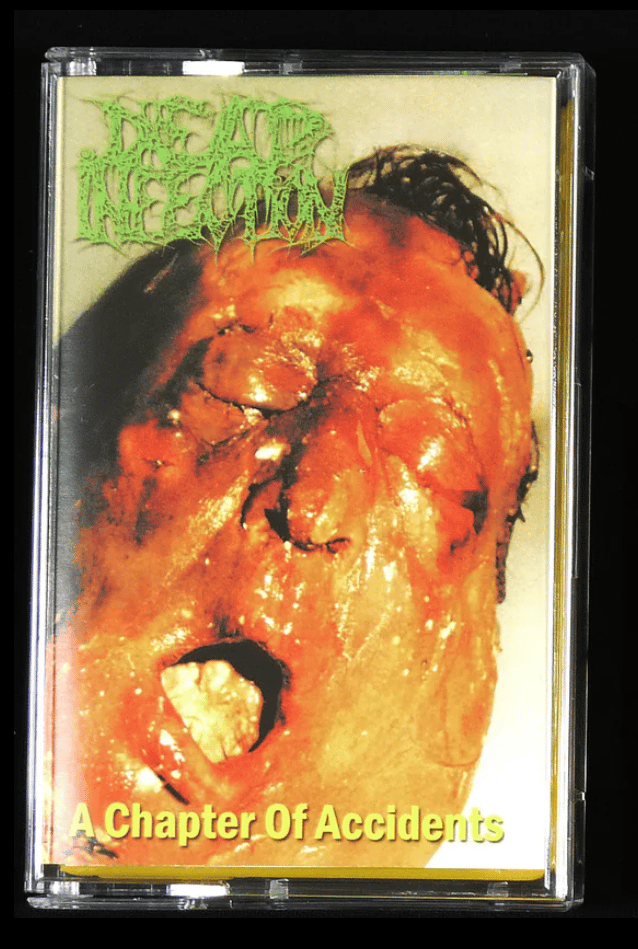 Image of Dead Infection - A Chapter Of Accidents Cassette