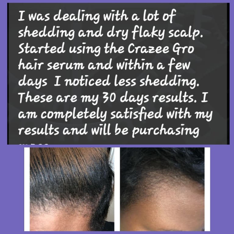 CRAZEE GRO Image 4