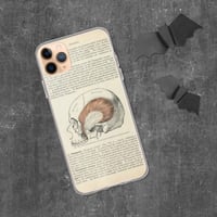 Image 2 of Antique Bookpage Detailed Anatomical Illustration Human Skull Clear Case for iPhone®