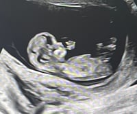 Package 1 "JELLY BEAN"