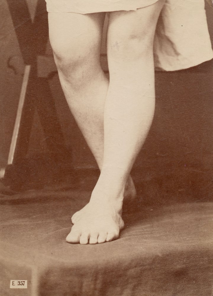 Image of Hermann Heid: figure study of legs, ca. 1875