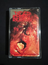 Image 1 of DEAD INFECTION - “A Chapter Of Accidents”