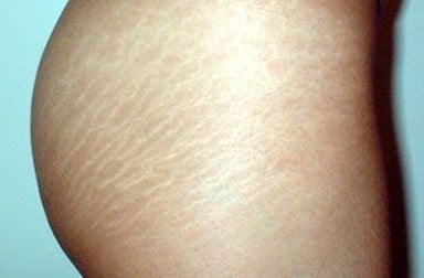 B-A-T-A-N-A Hair/Scalp Nourisher/Regenerator! Hair Loss. Eczema/Acne. Stretch Marks/Scars. UV Rays