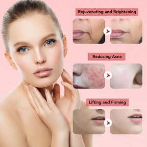 Image of 7 in 1 Face Lift Devices EMS RF Microcurrent Skin Rejuvenation Women Facial Massager Light Therapy 