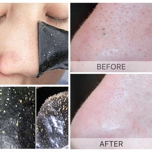 Image of Unisex Blackhead Remove Mask Peel Nasal Strips Deep Shrink Cleansing Pore Nose Black