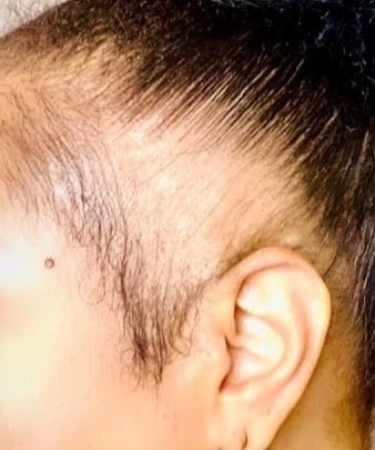 B-A-T-A-N-A Hair/Scalp Nourisher/Regenerator! Hair Loss. Eczema/Acne. Stretch Marks/Scars. UV Rays