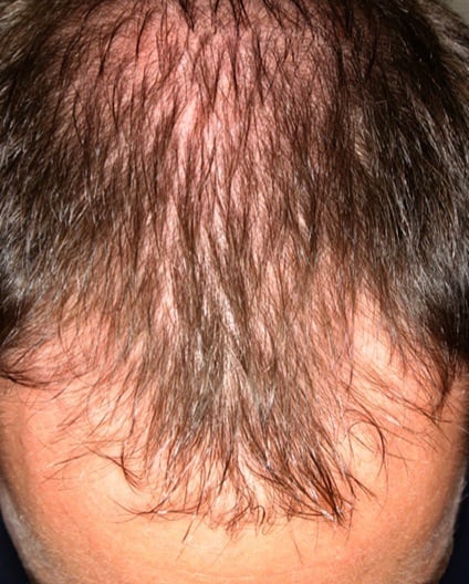 B-A-T-A-N-A Hair/Scalp Nourisher/Regenerator! Hair Loss. Eczema/Acne. Stretch Marks/Scars. UV Rays