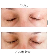 Image 2 of Brow, Eyelash, Hair Growth Elixir  