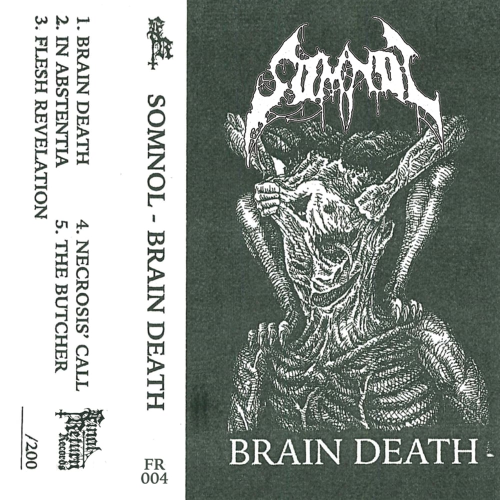SOMNOL-BRAIN DEATH
