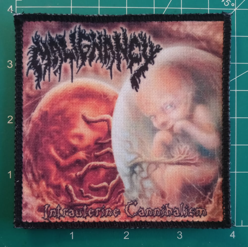 Malignancy - Intrauterine Cannibalism (band) patch